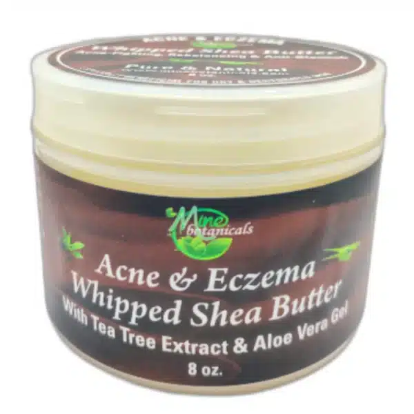 Acne Eczema Whipped Shea Butter 1 behalaal